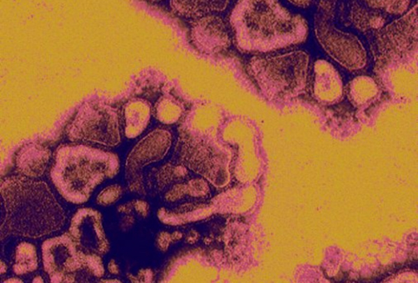 Вирус H1N1 (свиного гриппа)