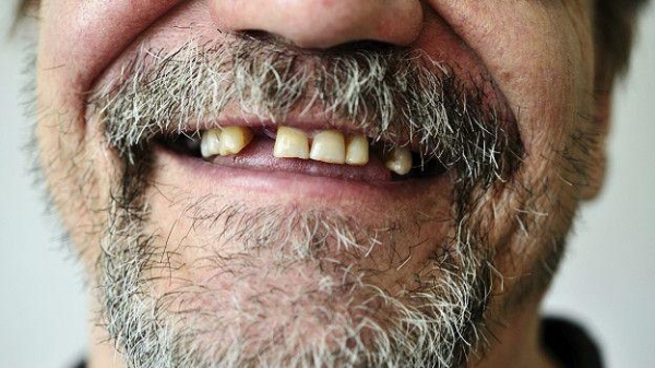 Жить без стоматологии было бы очень больно