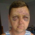 В Запорожье неизвестные нападают на участников АТО