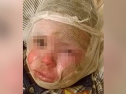 Ульяновские коллекторы объяснили, почему подожгли двухлетнего ребёнка